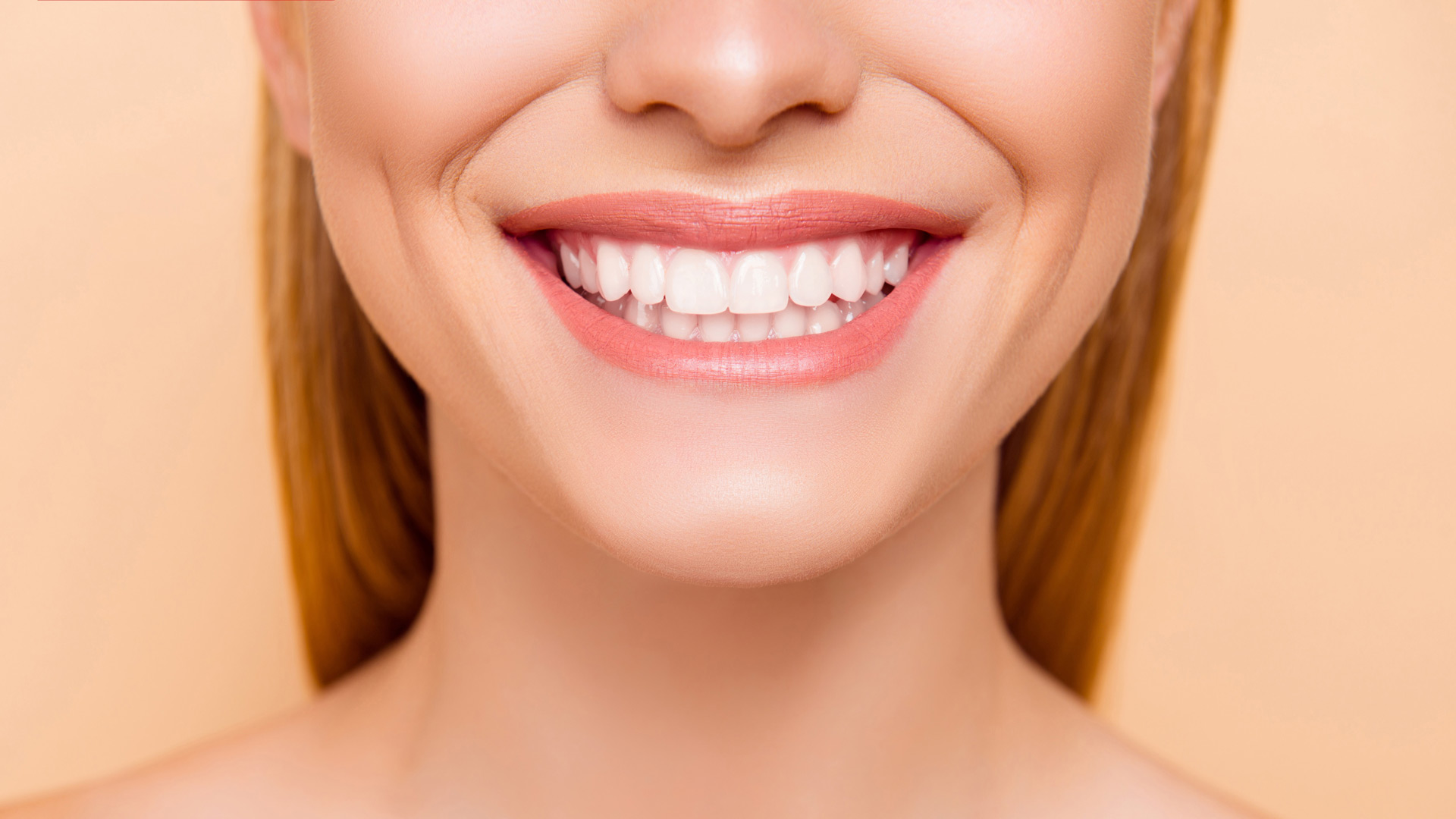 Zahnarzt Würenlos – Zahnfüllung